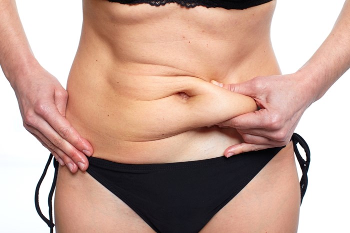 Tummy Tuck: Procedure, Benefits, and Risks 1 tummy tuck