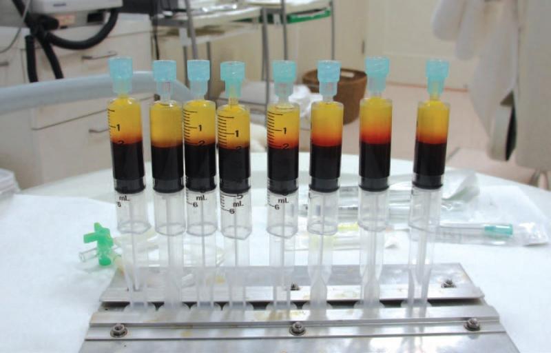 Untitled.118225611 std