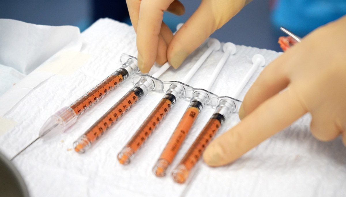 Injerto de grasa en la cara